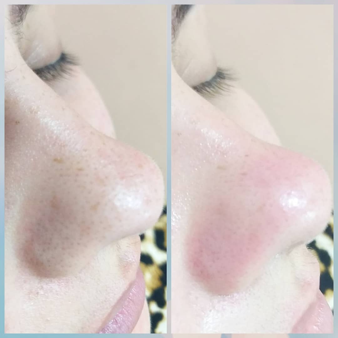 Limpeza de Pele Premium
